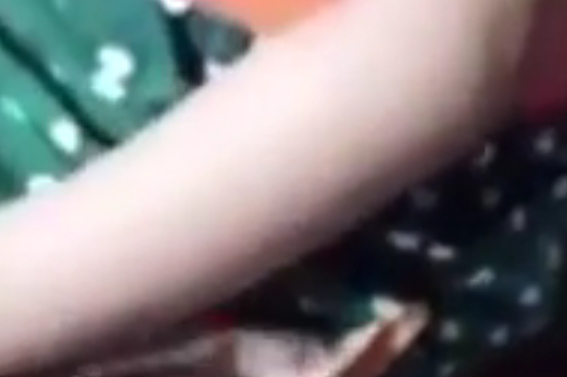 【幼儿园老师玩了个游戏 女儿回家身上多出针孔】广东江门的李先生夫妇近日反映,自己4岁多的女