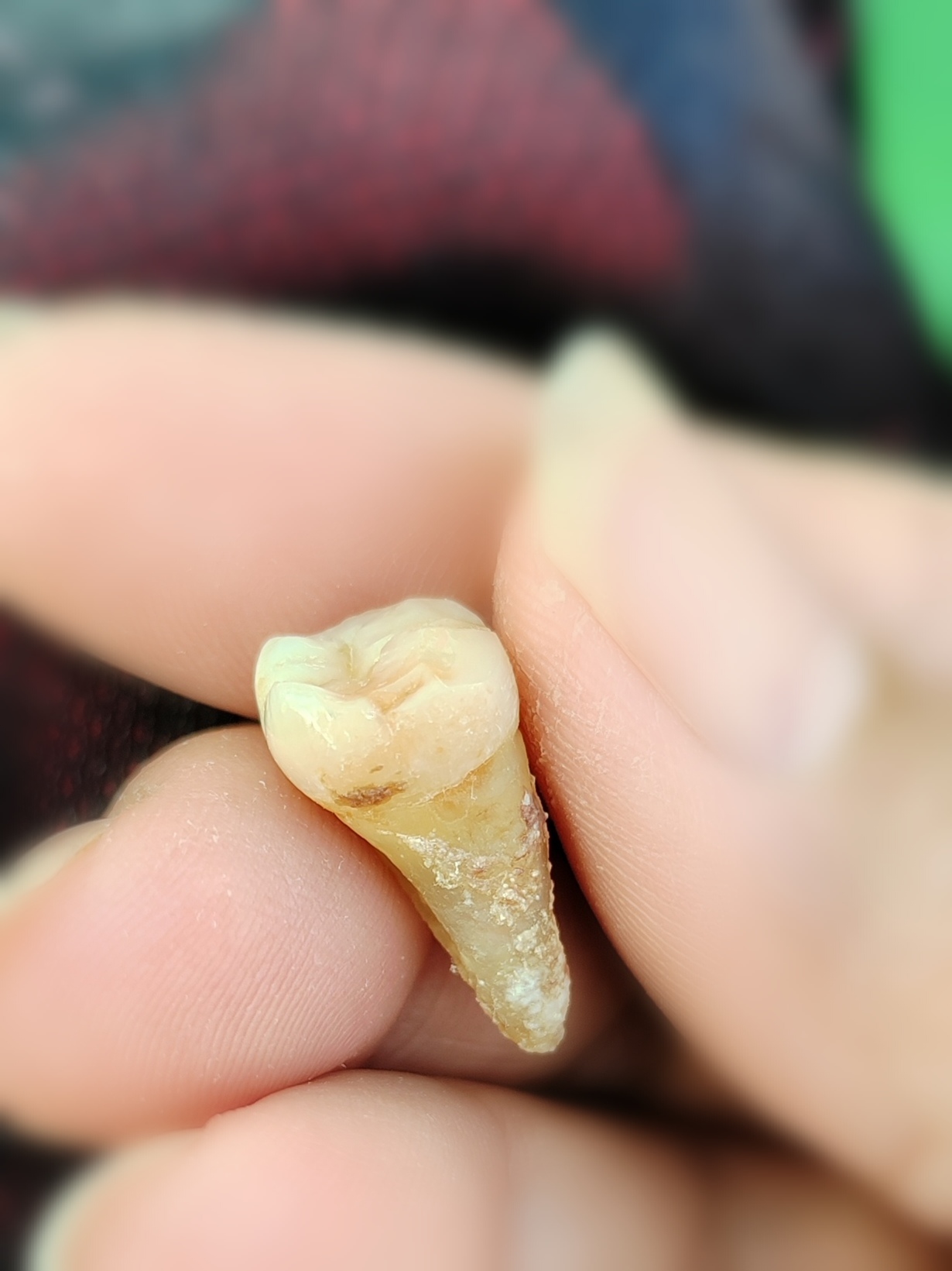 这颗大牙早就松动的,这几天竟是可以听到牙齿咔咔的撞击声.
