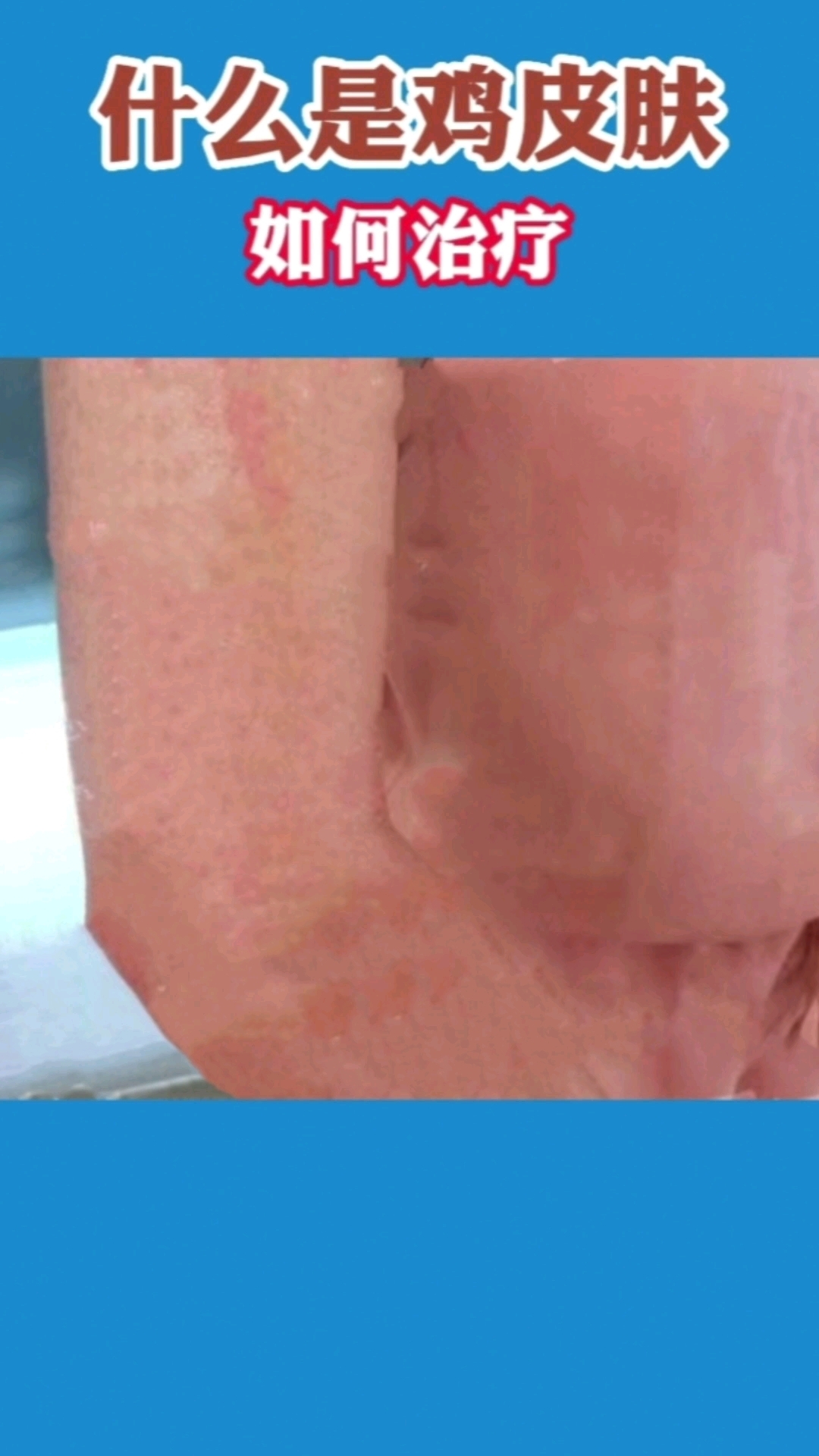 #重庆皮肤科去哪个医院比较好# #重庆皮肤科医院#