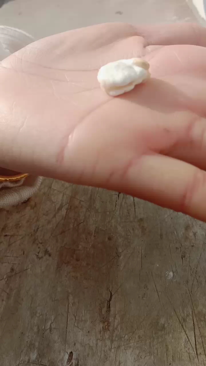 带鱼结石