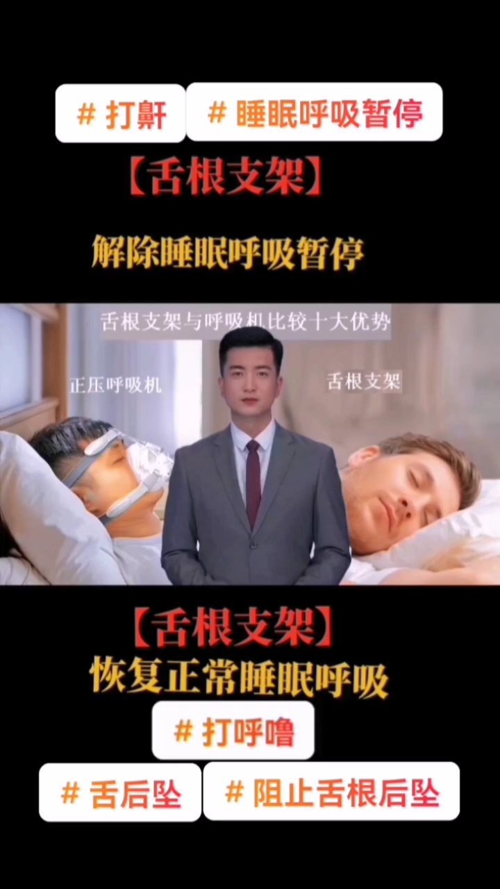 舌后坠是怎样形成的 也可以说没有睡眠舌根后坠就不会出现打呼噜、睡眠呼吸暂停。我们通过(图1