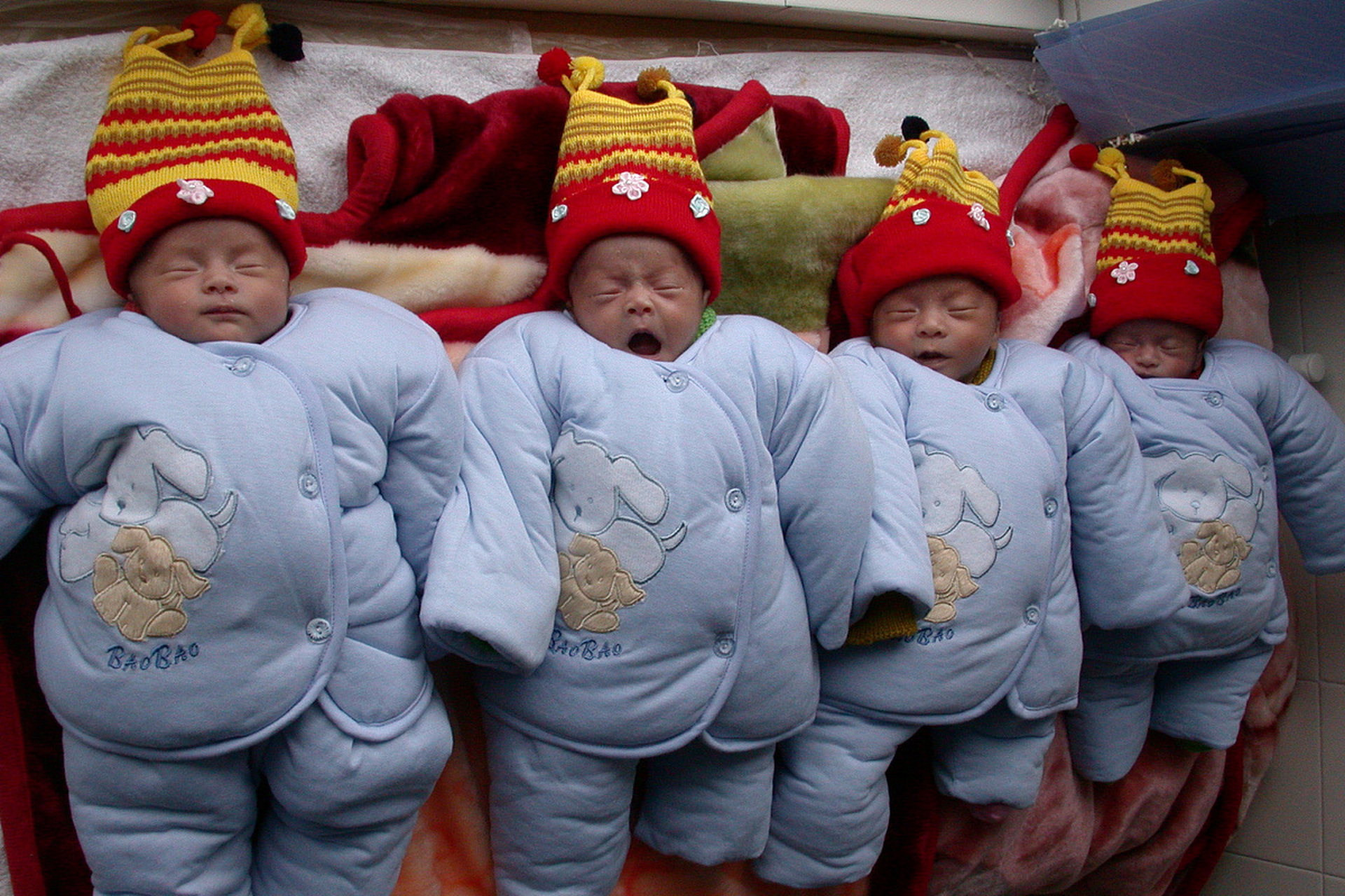 生四胞胎后又怀四胞胎女终止妊娠