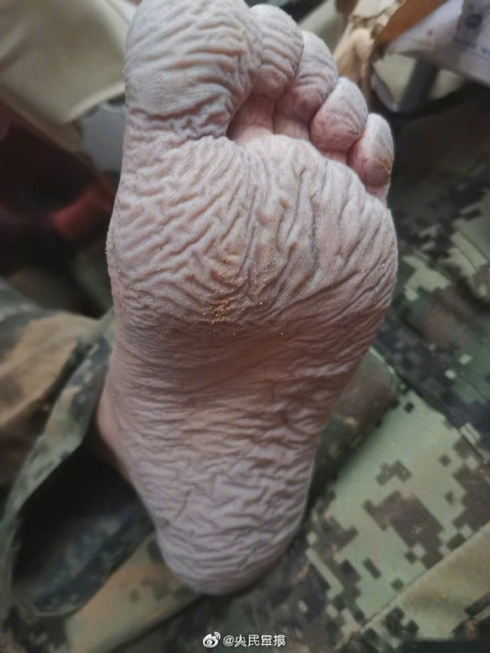 抗洪武警的脚被泡到起皱发白】7月20日,武警河南总队机动支队官兵在