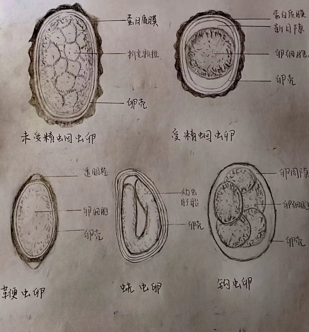 人体寄生虫学##医学生##医学生笔记# #未受精蛔虫卵##受精蛔虫卵