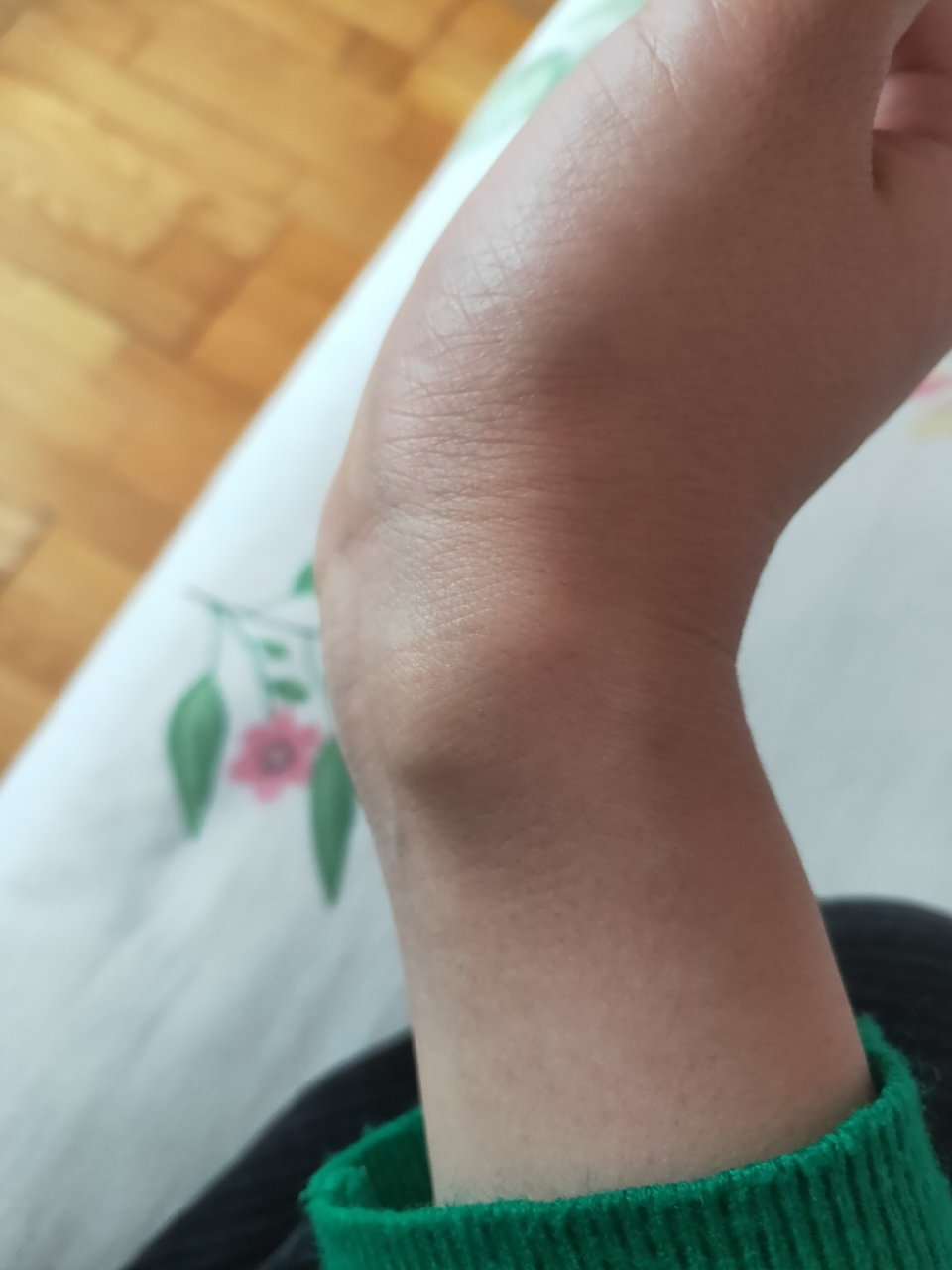 年初发现了,后来问中医说是腱鞘囊肿不用管,我也没再管,但是手腕不能