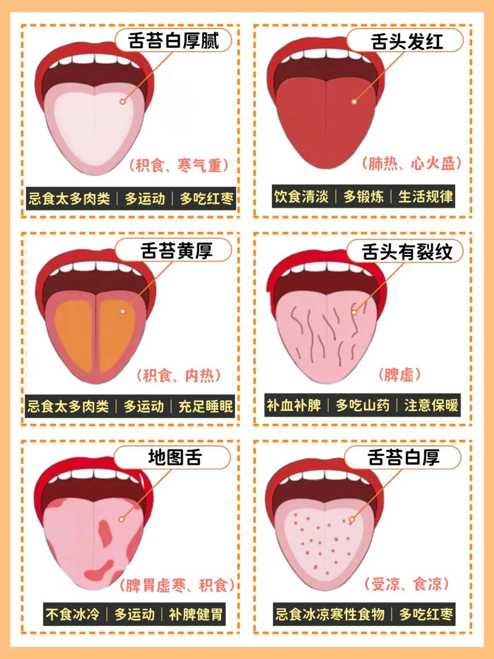 看看宝宝的舌头,如果是这种症状就要留意啦 宝宝的舌头能提前告诉你