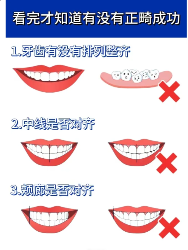 正确咬合示意图图片