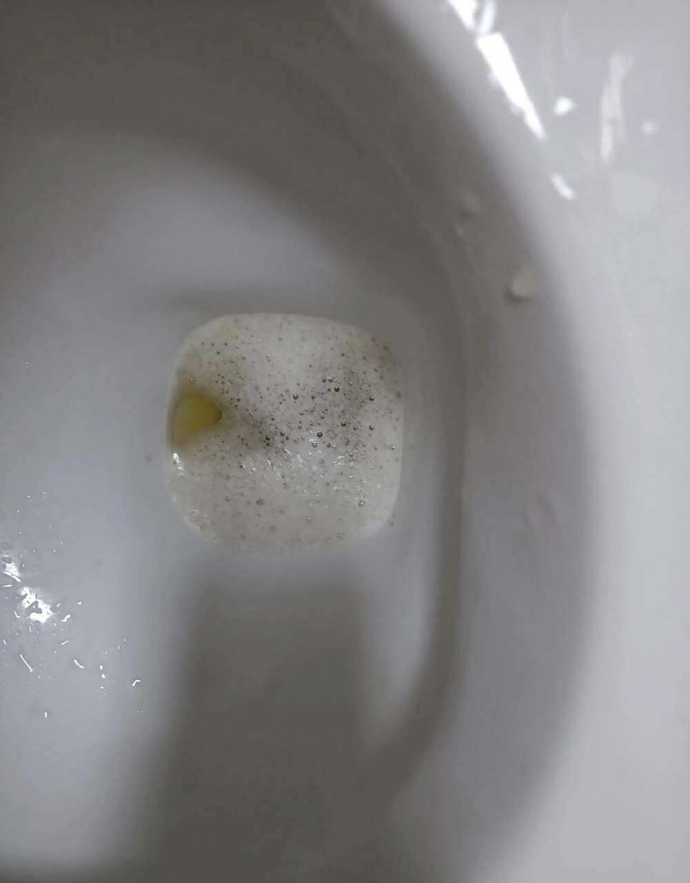 很多肾病患者可能都听说过,蛋白尿跟肾脏功能有关系,但具体是怎样的