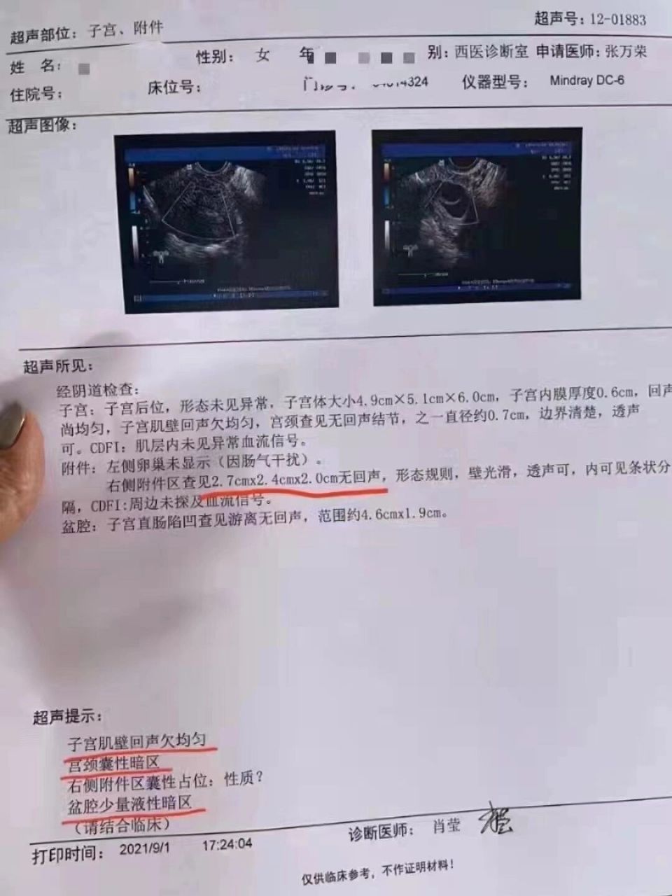 宫颈囊肿 是不是有点好了