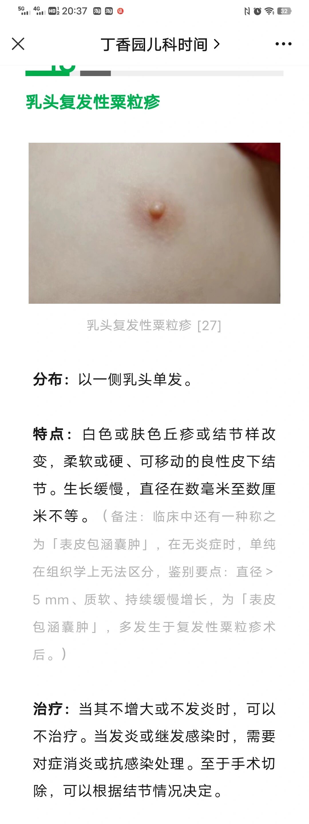 新生儿乳头上长了小包怎么办