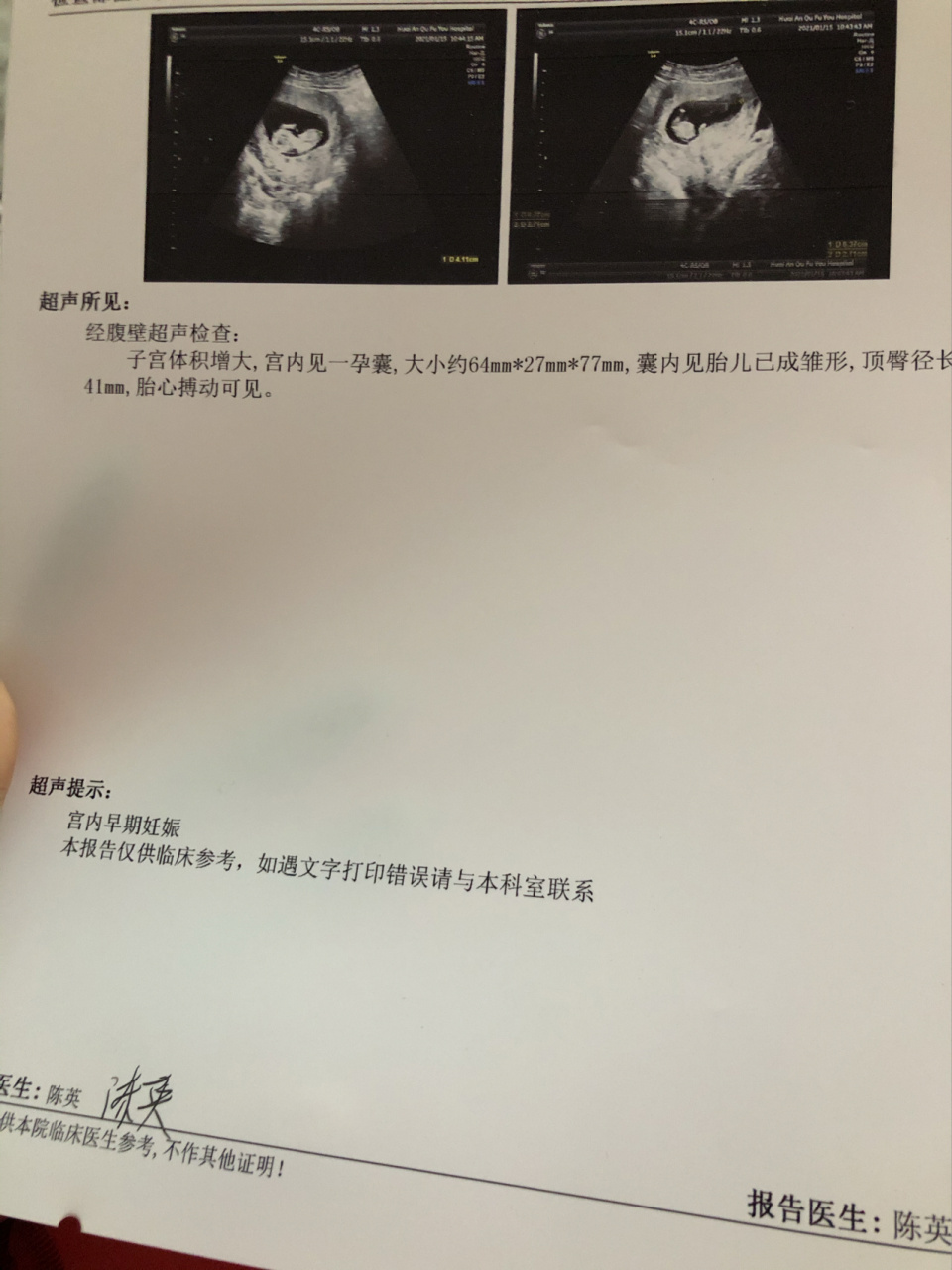 11周的b超单,看是男孩女孩啊