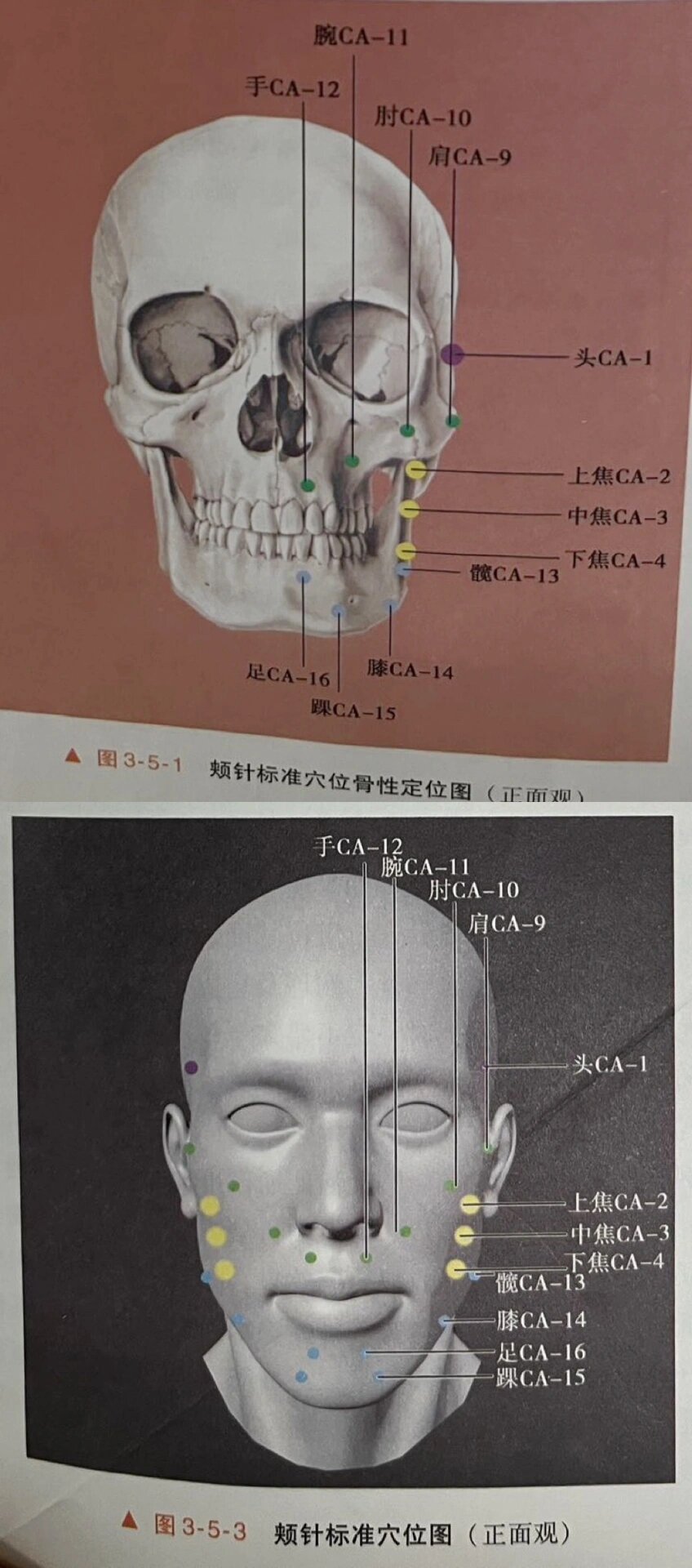颊针 基础穴位定位 1.基础穴位共16个. 2.