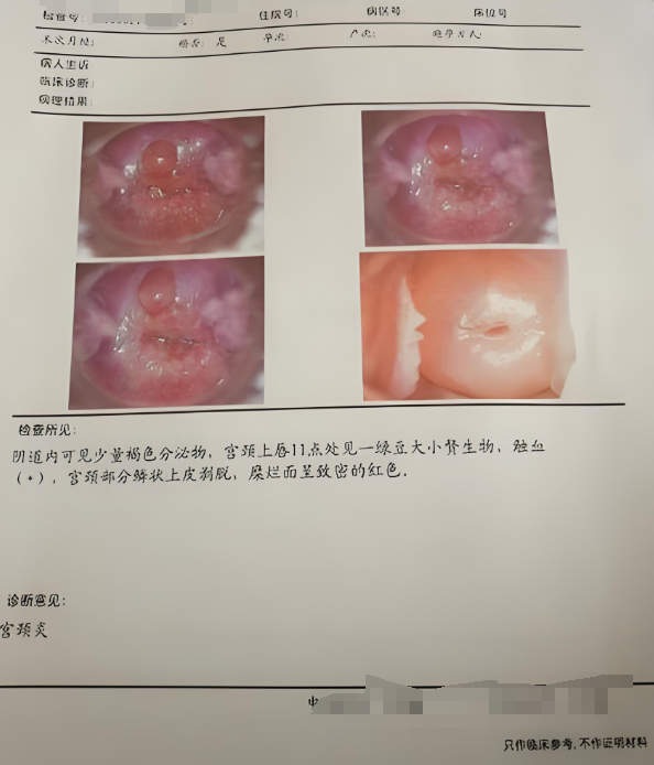 妇科炎症的治愈时间要看具体类型