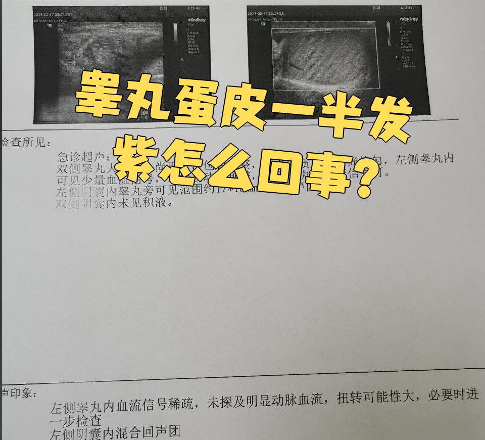 常见的原因包括外伤,阴囊湿疹,精索静脉曲张,睾丸扭转,紫癜或血管瘤等