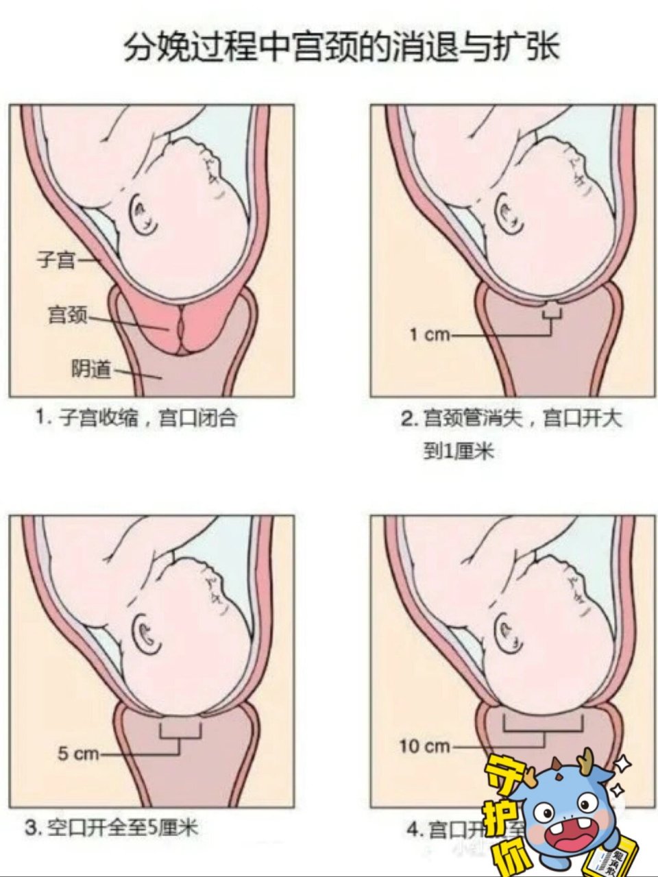 自然分娩宫口开图片图片