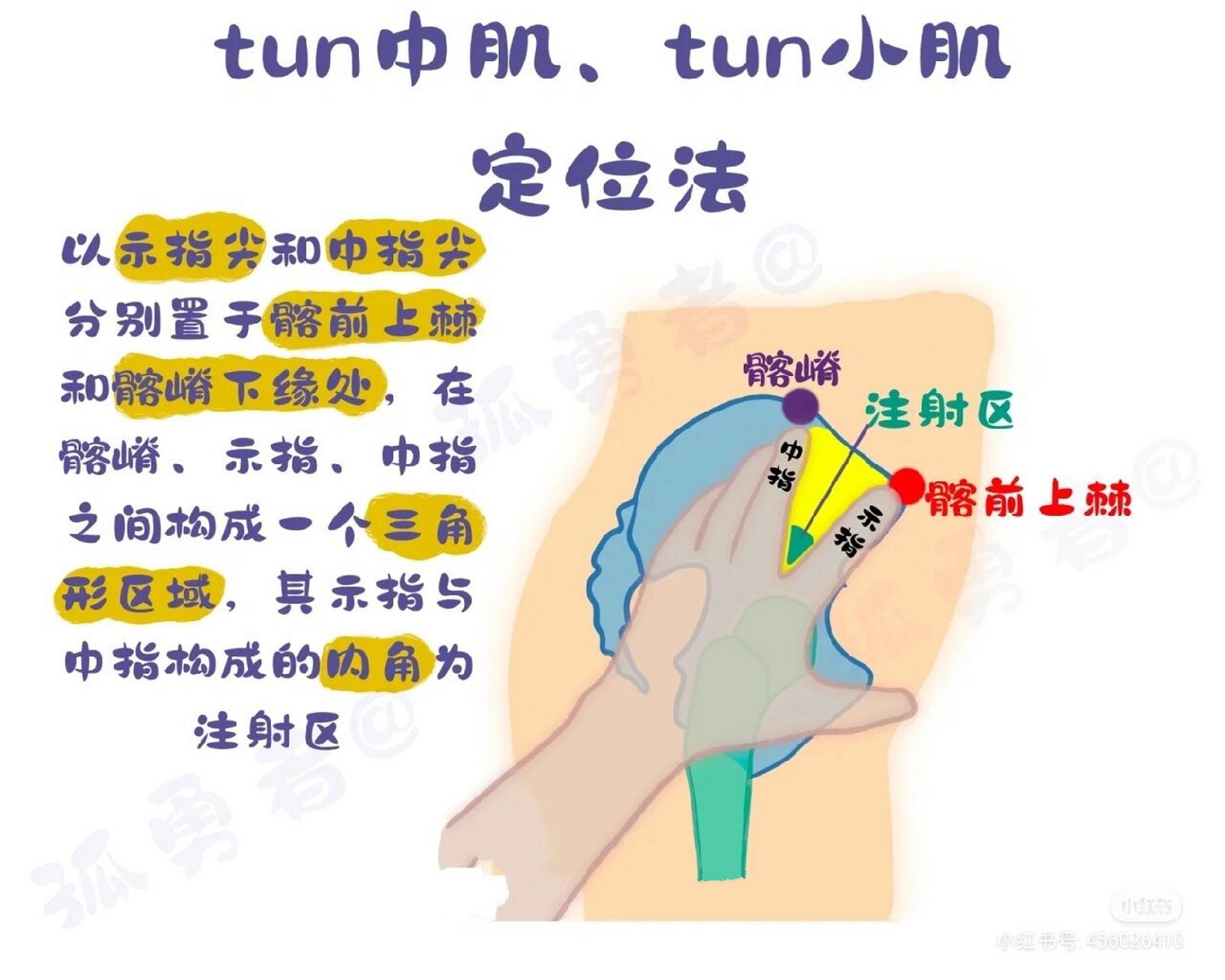 肌注部位图片