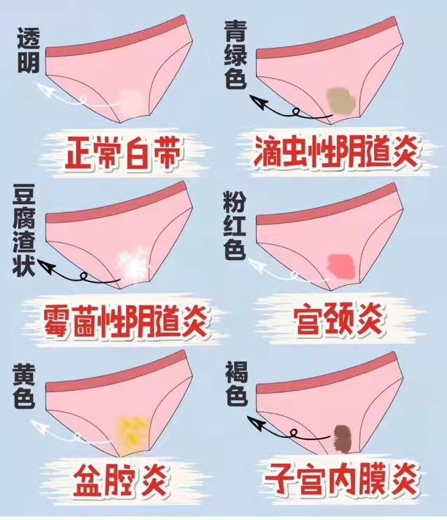 需要特定的条件,因为女性的阴道有一套自净系统,可以清除霉菌,但是这
