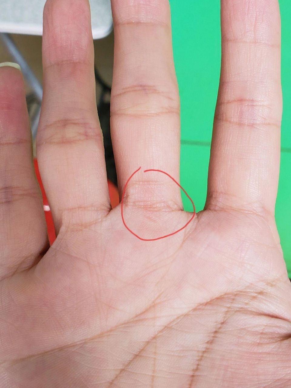 手指上有一粒东西 手掌和手指连接处摸着有个东西在里面,还有点疼,会