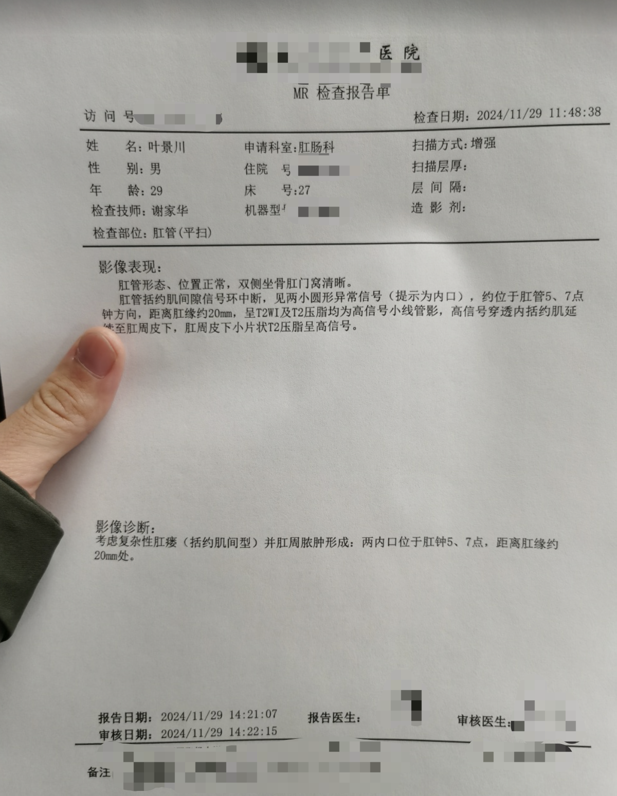 肛门有堵塞感常见原因有这些: