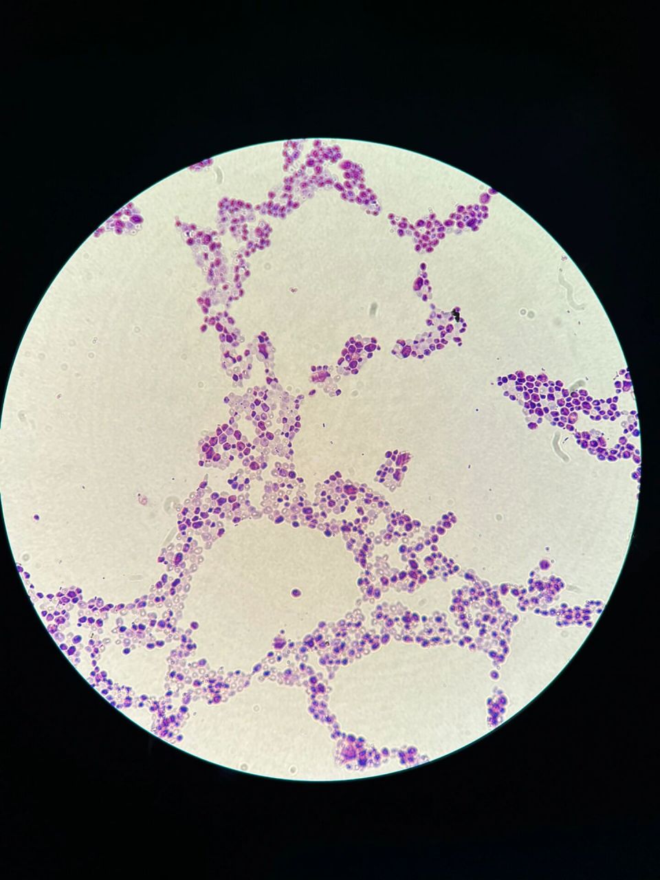 白假丝酵母菌落形态及显微观察 一般我们看到酵母都椭圆形的圆乎乎的