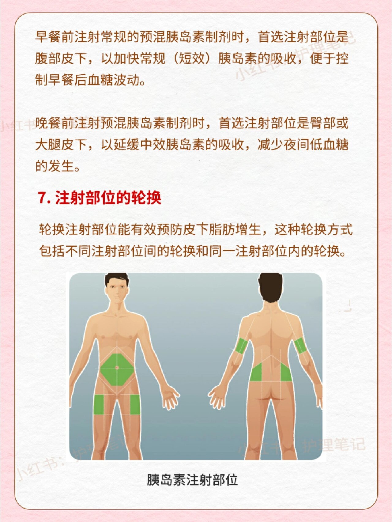 胰岛素注射方式(最详细图解)快收藏!