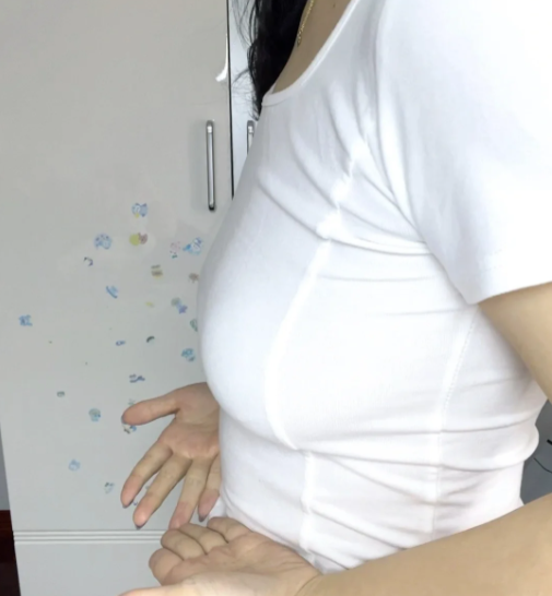 产后胸部松弛下垂主要是怀孕和哺乳期激素变化导致的