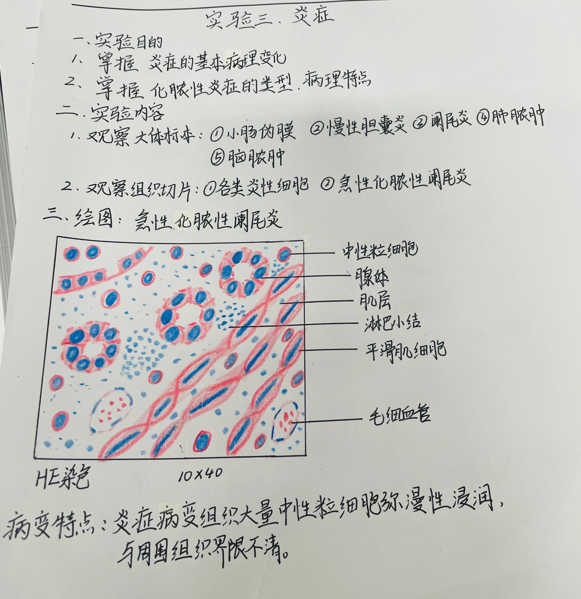 病理学实验报告红蓝铅笔图 1急性化脓性阑尾炎 2鳞状细胞瘤