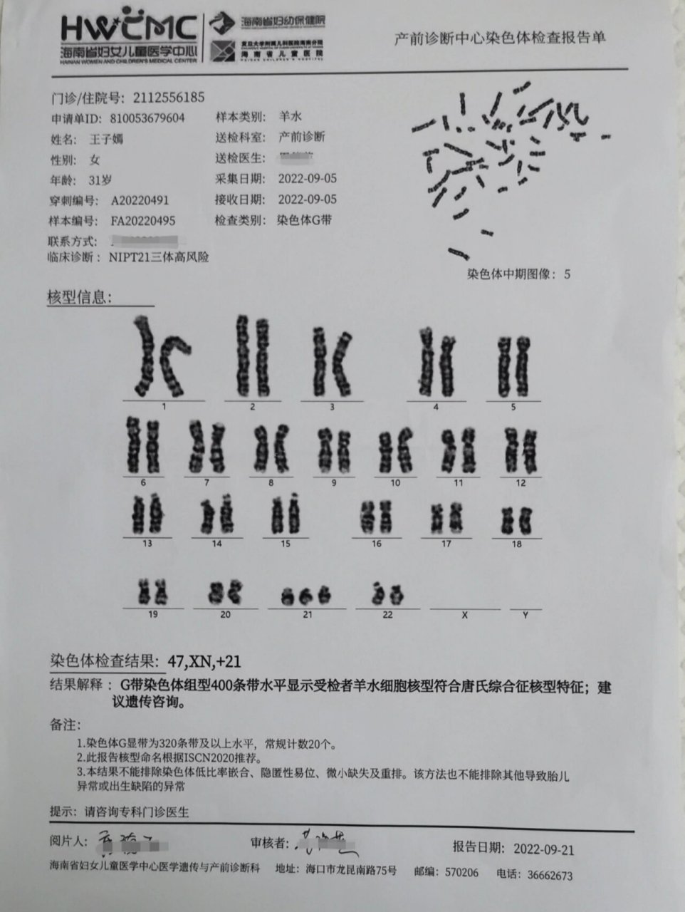 羊穿染色体核型报告 请问有没有相同经历的姐妹会看这个报告的呢?