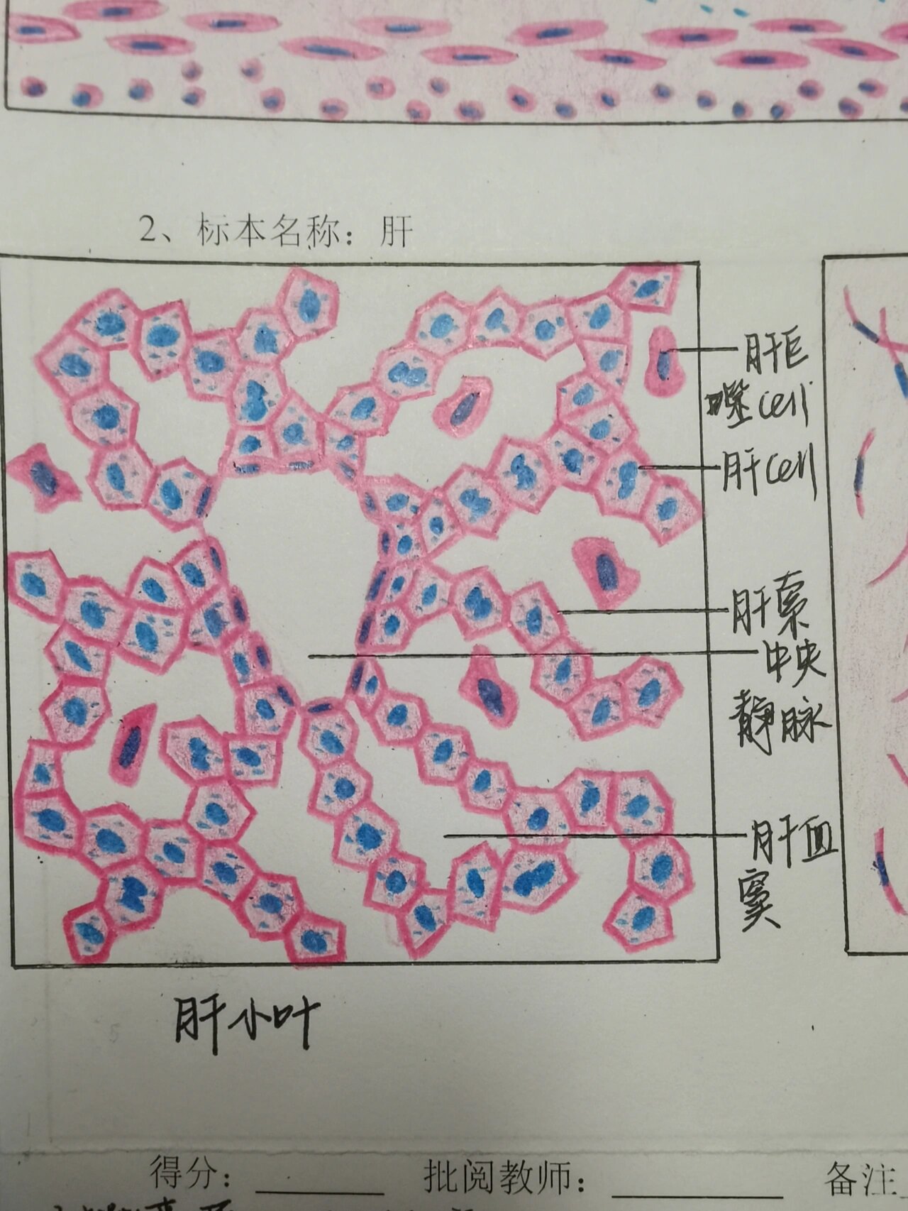 肝门管区图片