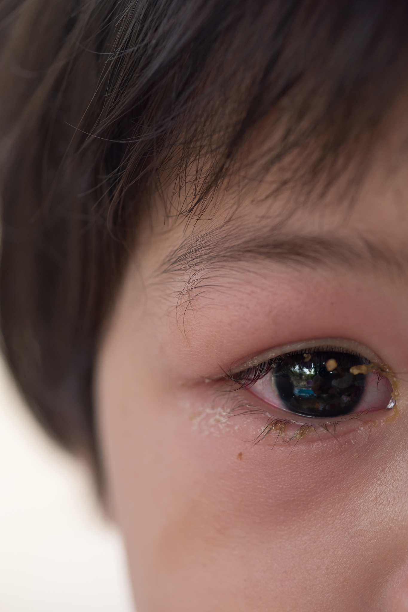6月9日,一名女孩在景区漂流时,竟遭高压水枪击中眼睛,导致失明!