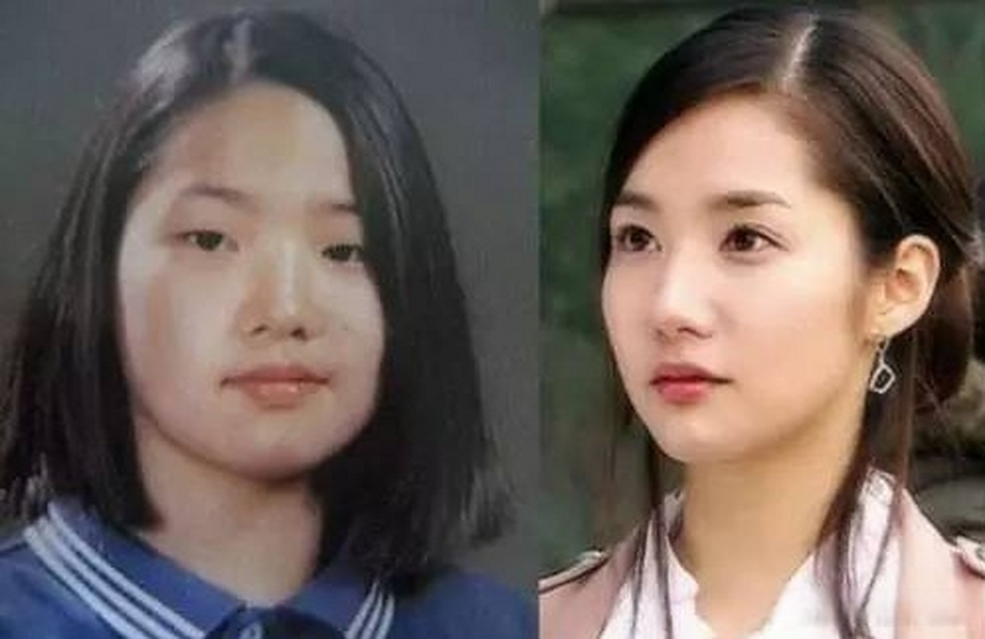 为什么明星整容越来越美!而普通人一整就是网红脸?