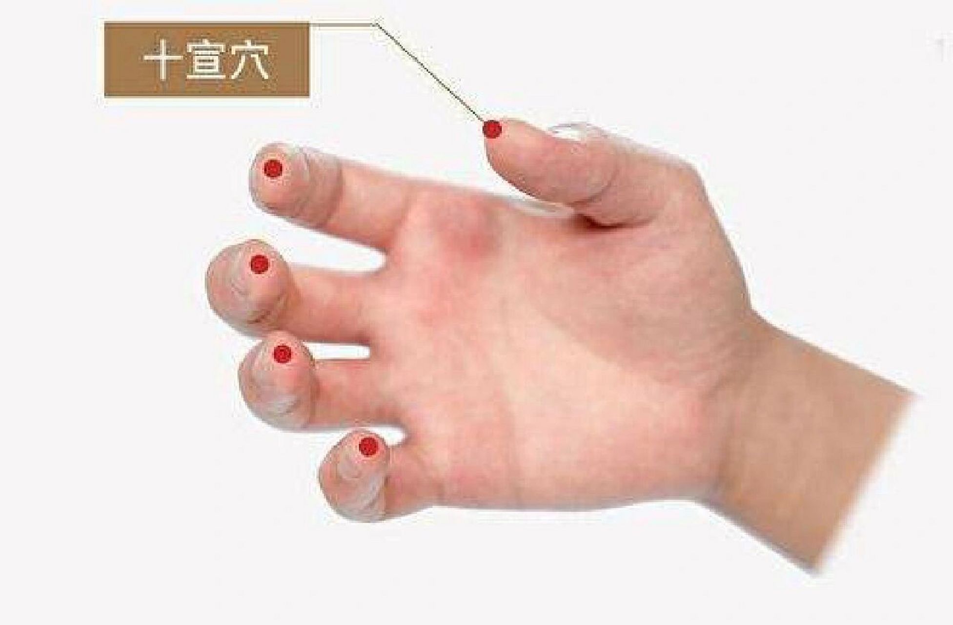 【十指放血能治什么病】 十指放血在中医临床上被称为十宣放血,可以