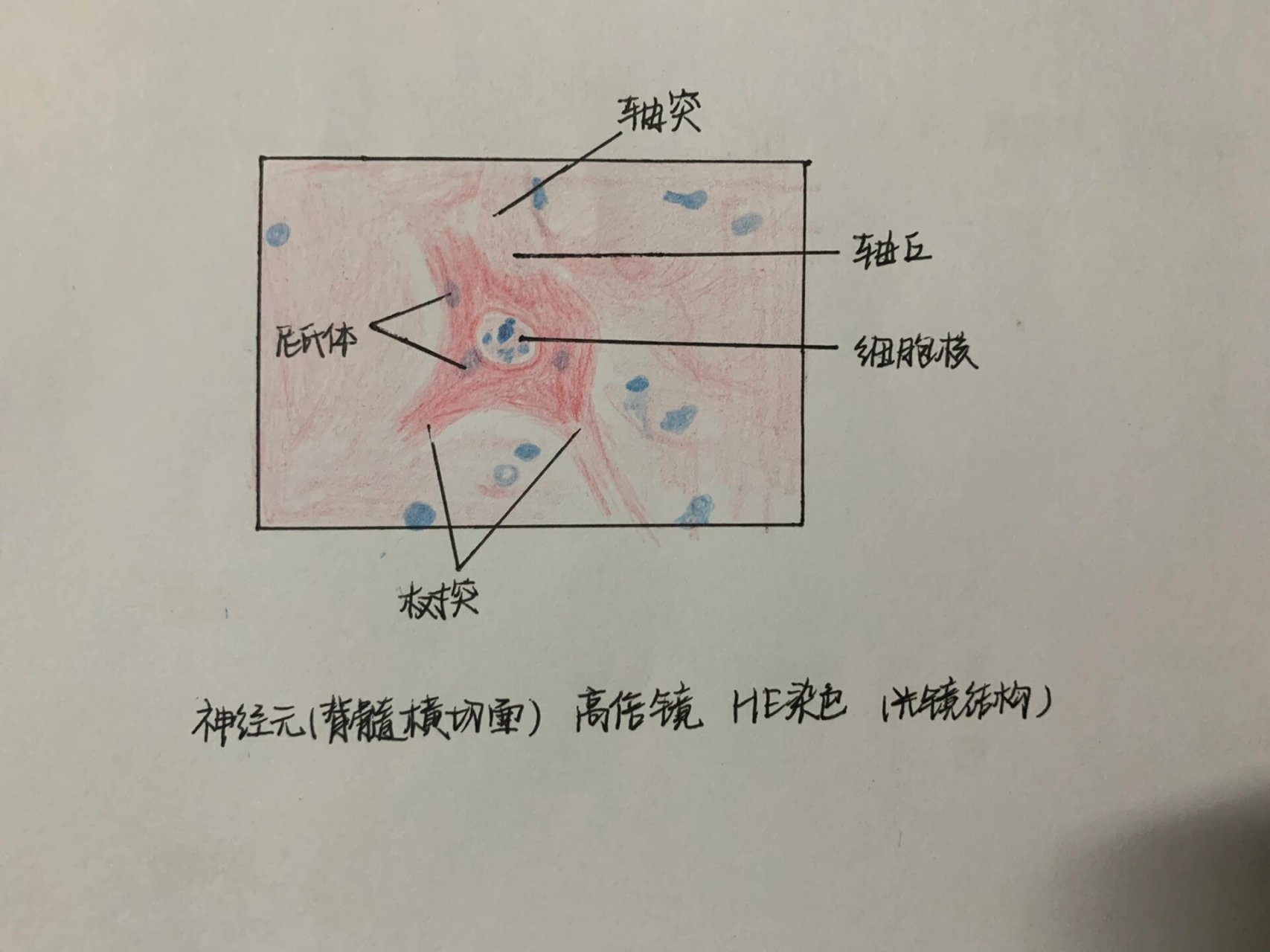 尼氏体手绘图片