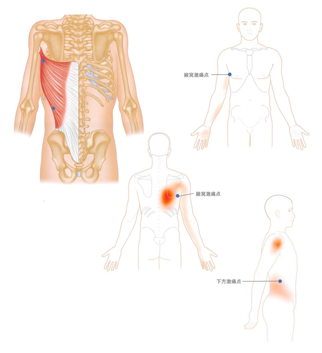背阔肌激痛点图片