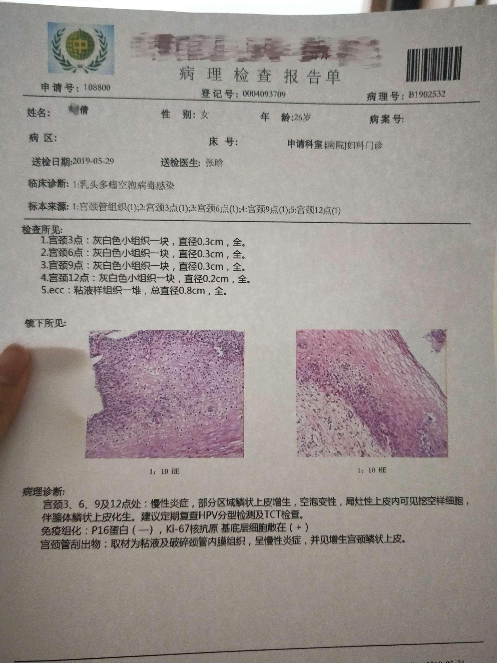 金波hpv敷料排出薄皮图片