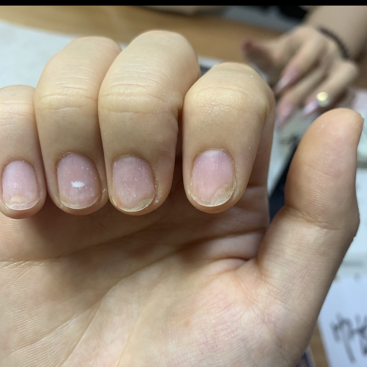 我的指甲空了怎么办啊!