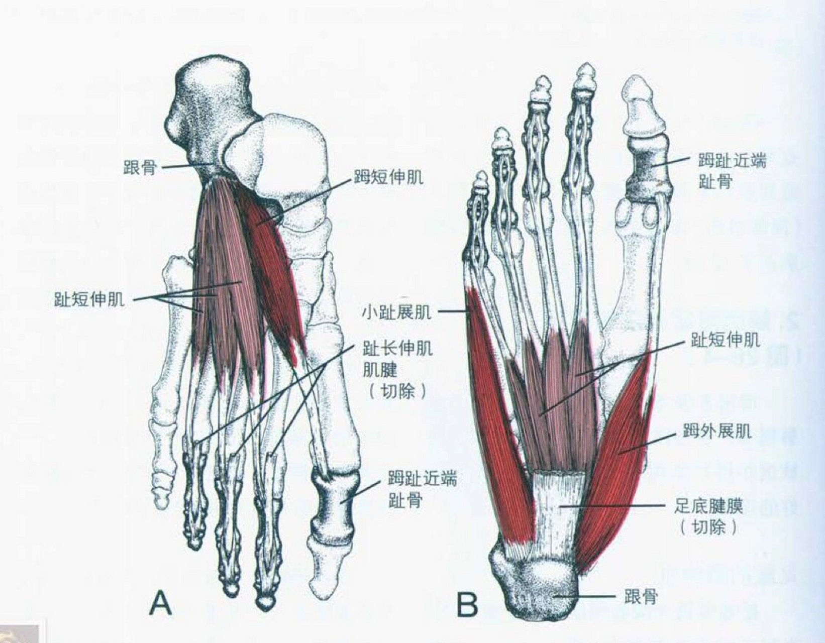 趾短屈肌起止点图片