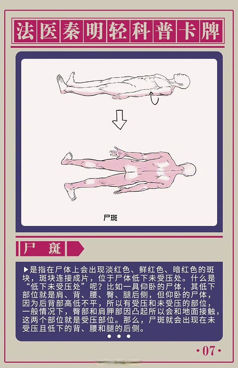 和损伤长得很像吗?法医是怎么区分尸斑和损伤的?