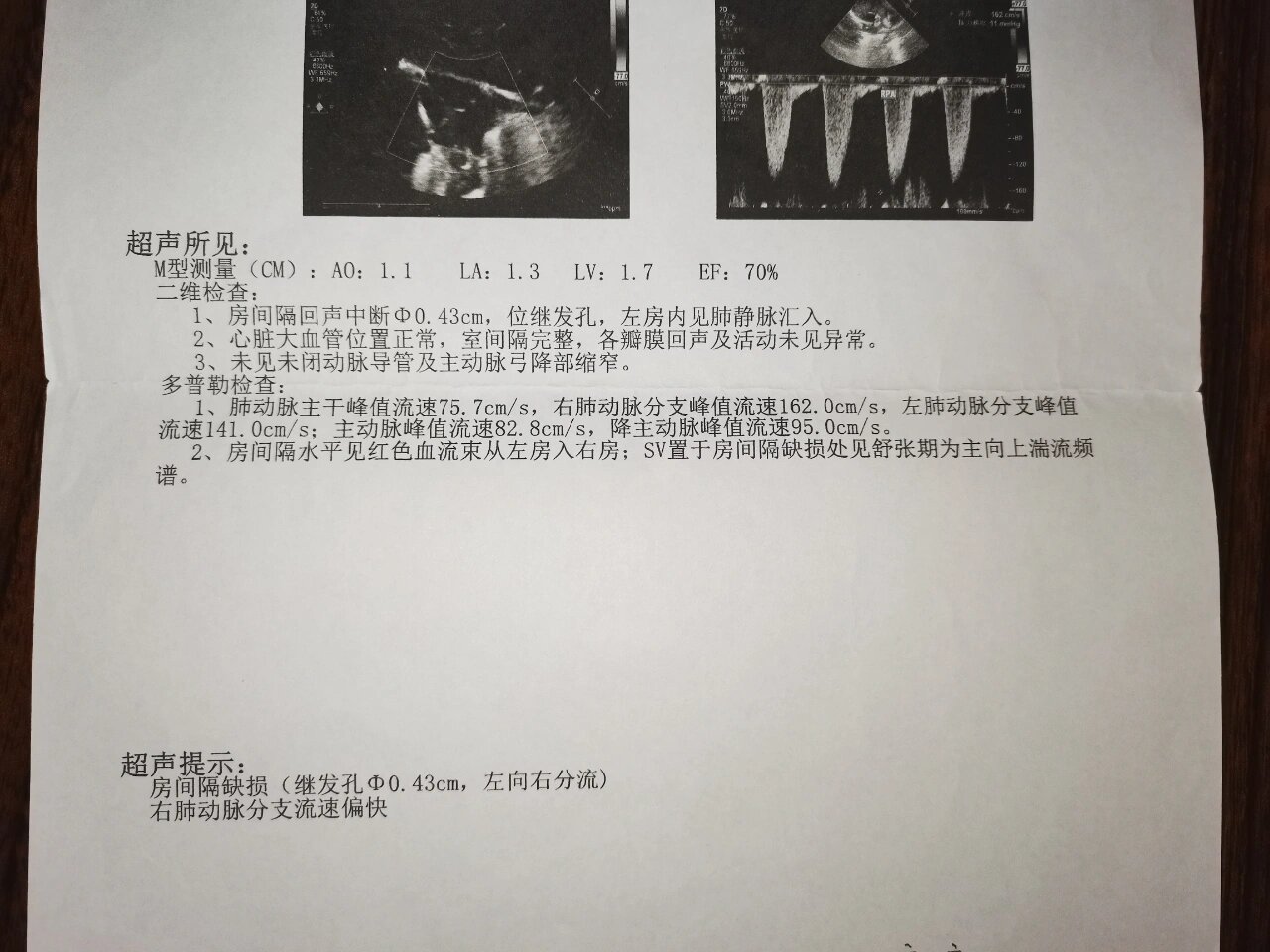 房间隔缺损自愈啦