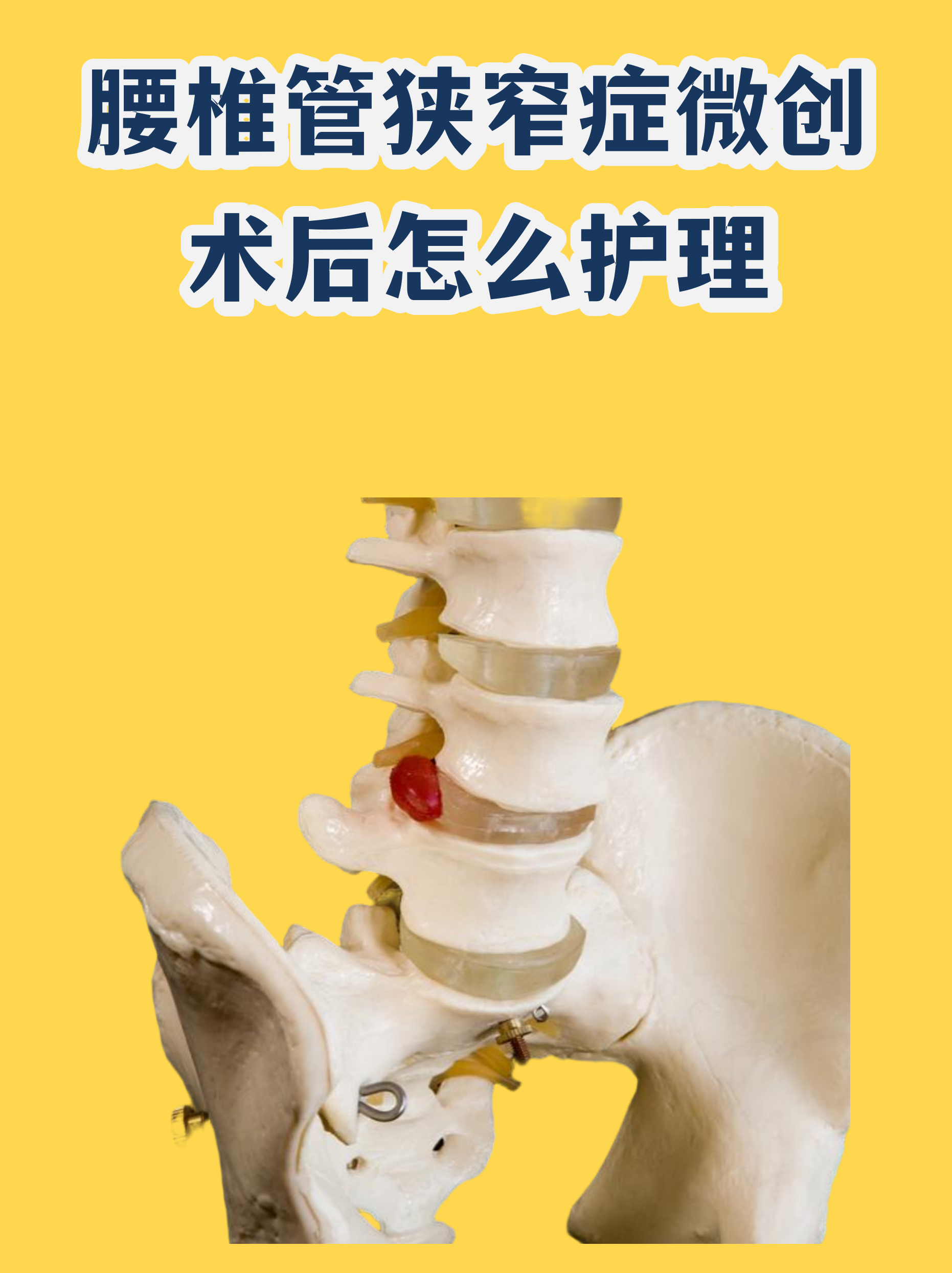 关于中国医学科学院阜外医院老年人看病代挂号术后伤口换药、复查全程陪同的信息