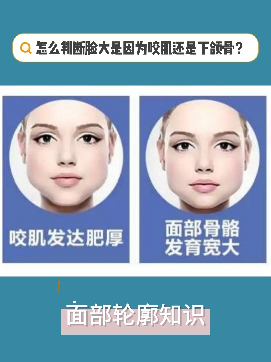 🌟咬肌和下颌角宽都会导致脸大,它们是怎么影响脸型的呢?