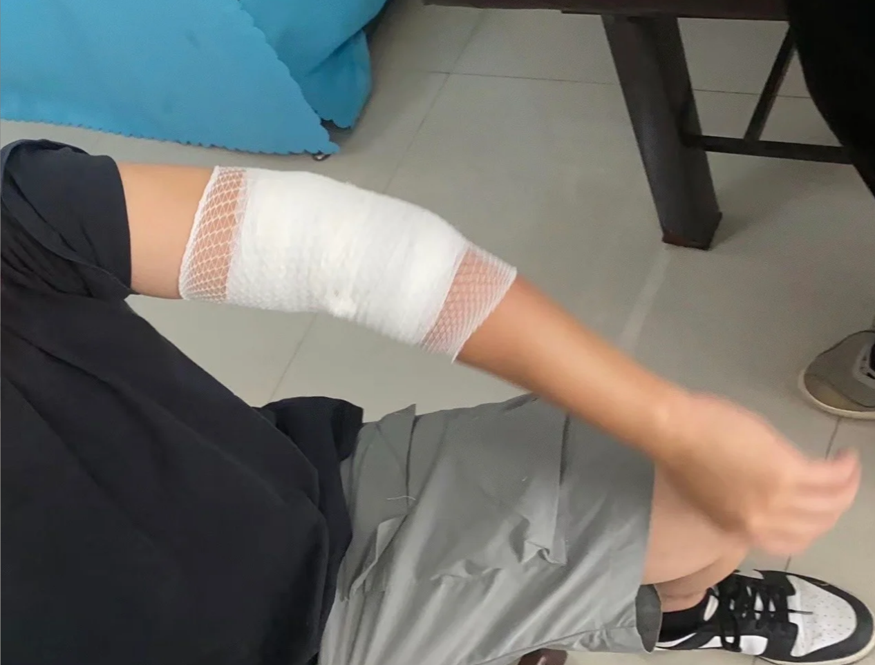 摔跤后胳膊一用力就疼是什么原因?