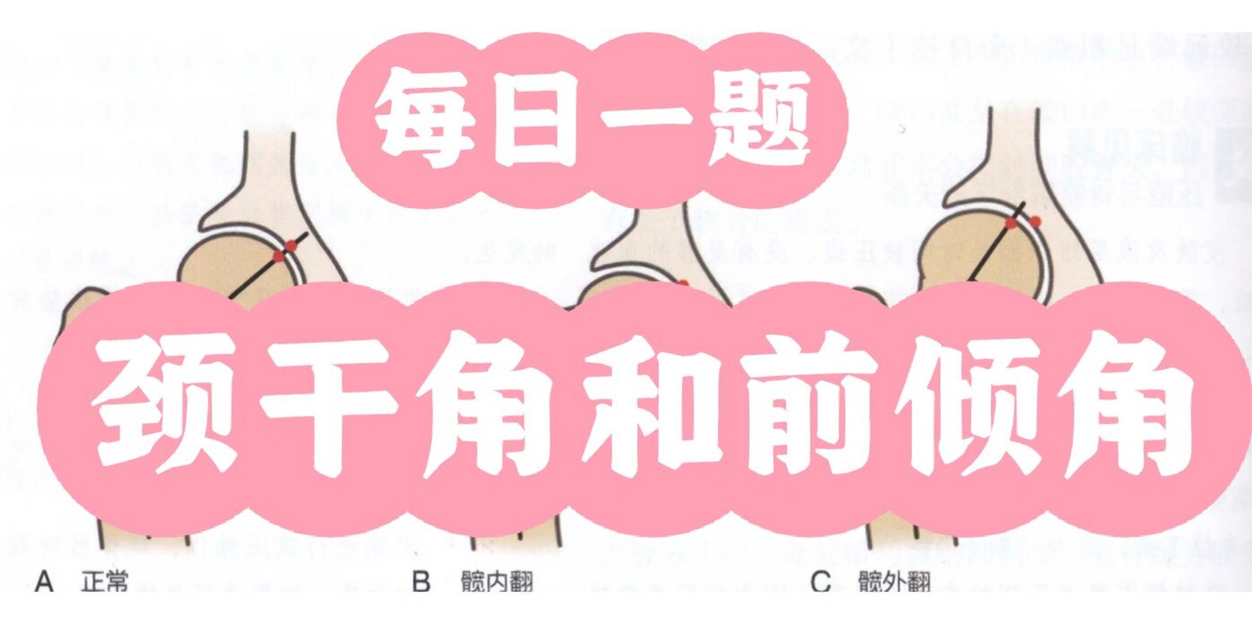 康复考研每日一题～颈干角和前倾角 今天的每日一题 今天是23年康理