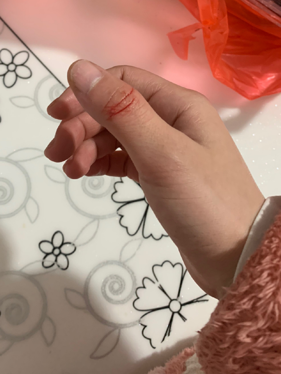 吃地上的脏东西,扣嘴巴的时候咬到的