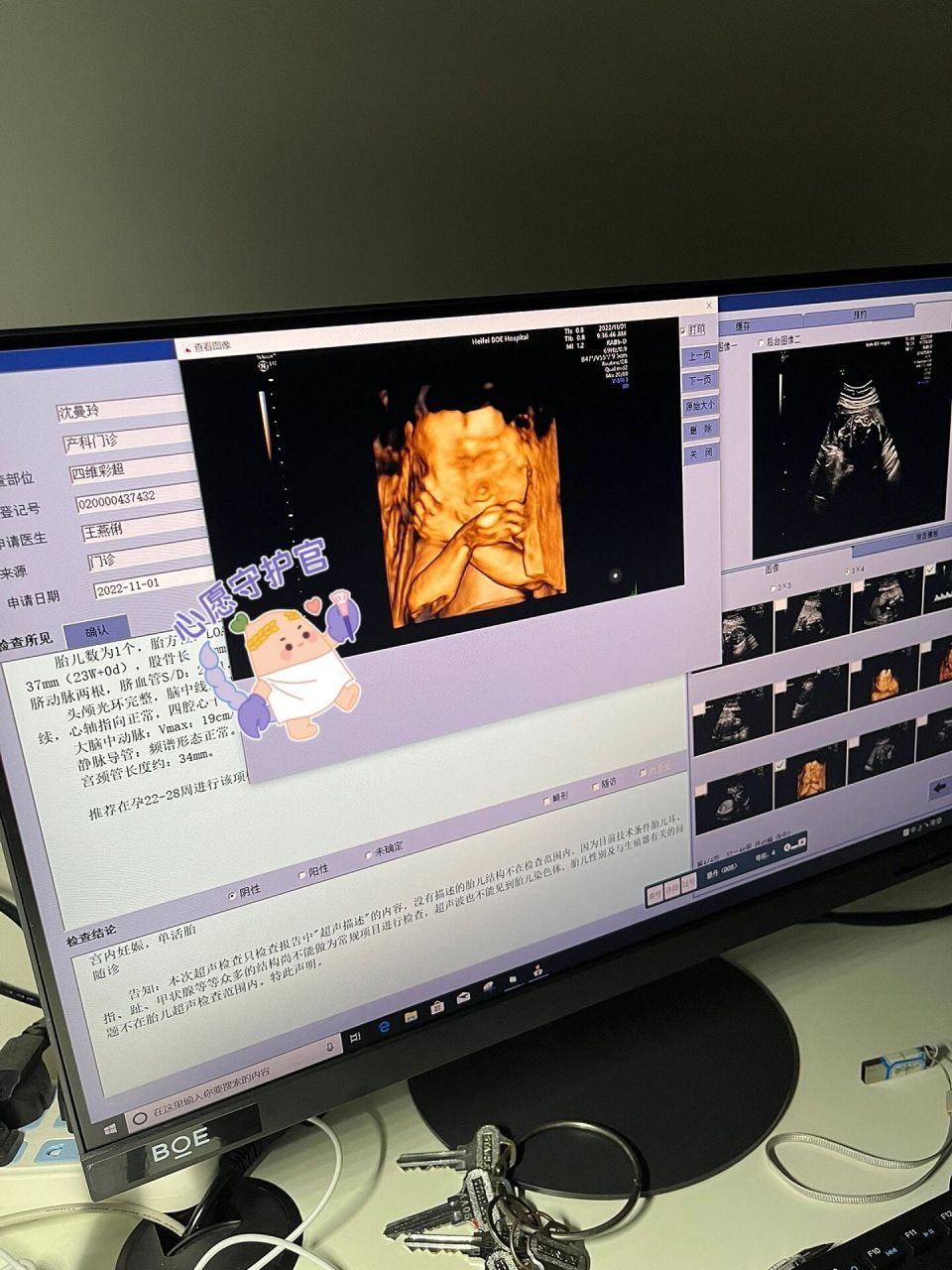 四维彩超秒过呀!