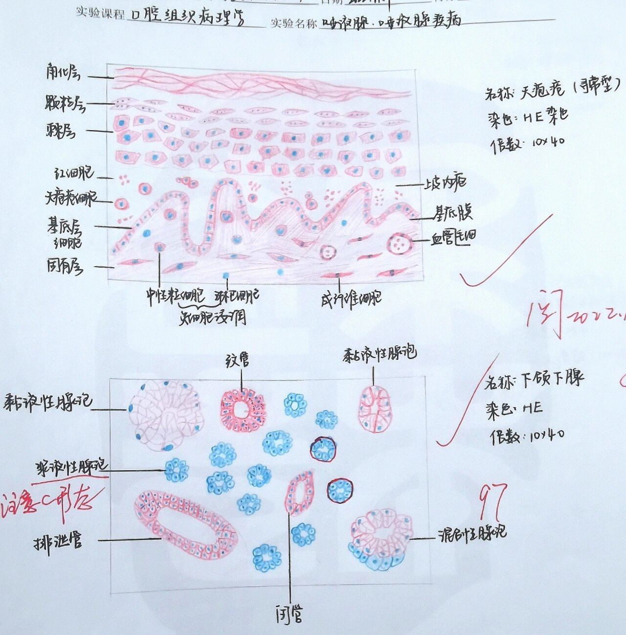 腺淋巴瘤红蓝铅笔绘图图片