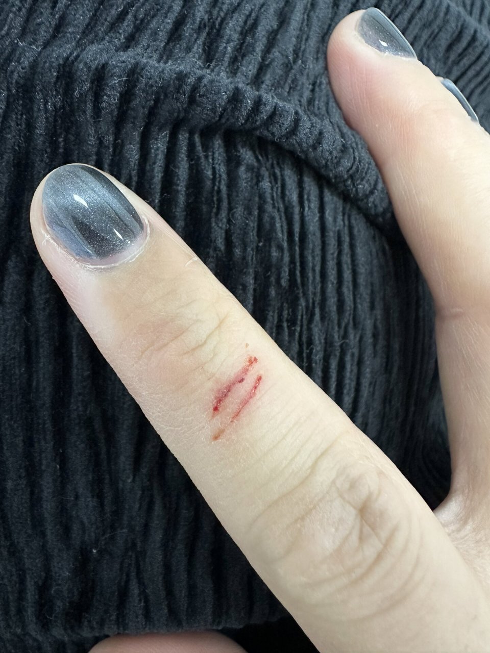 订书机划伤手指了,需要打破抗吗?