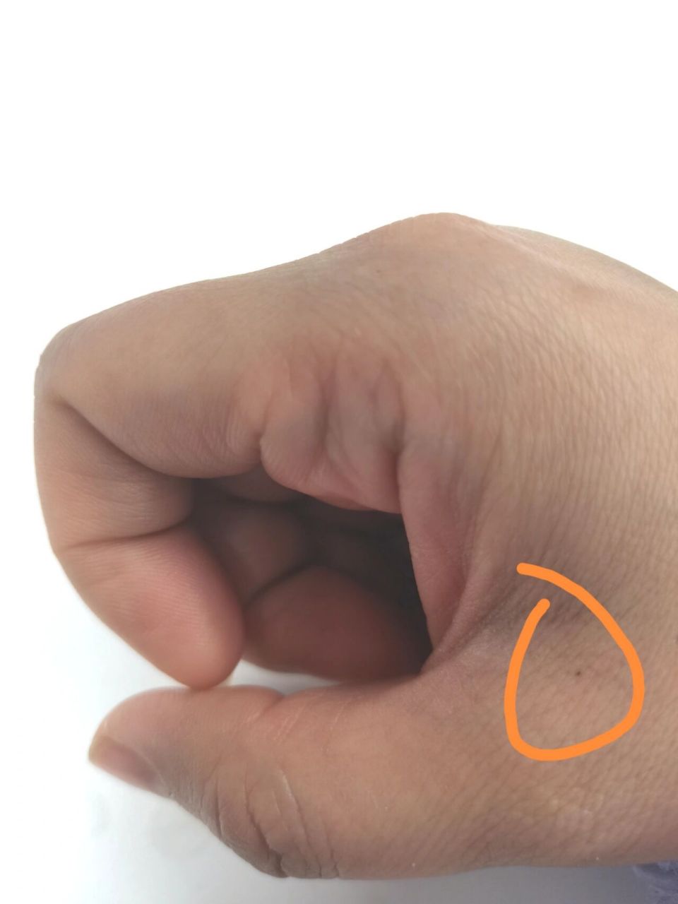 今日份迷信:右手虎口多了个痣 抠半天确定是个痣,不知啥时候有的.