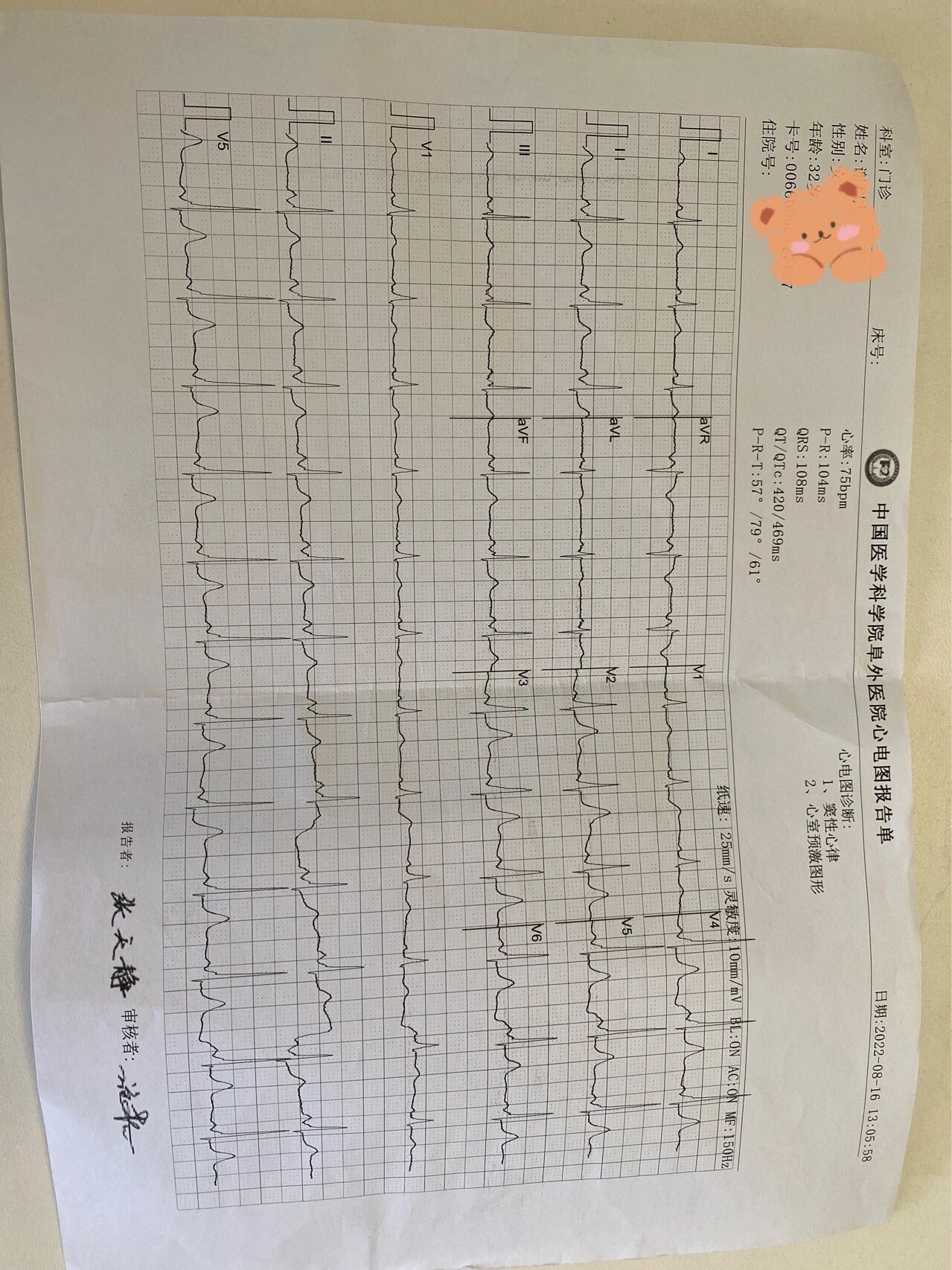 A型预激综合征图片