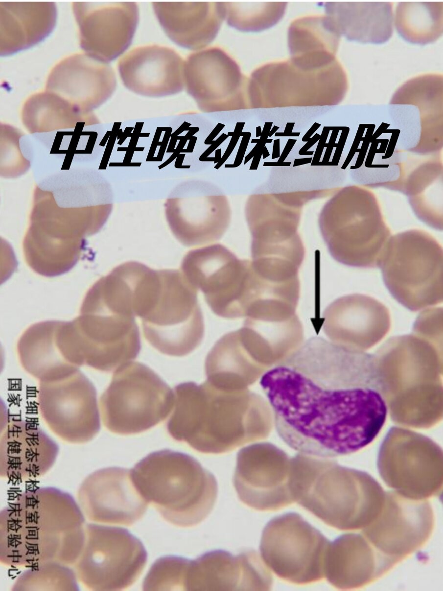 —血细胞形态学检查 👉  	 🍀中性晚幼粒细胞